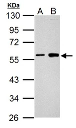 Anti-Cyclin B1 antibody used in Western Blot (WB). GTX100911
